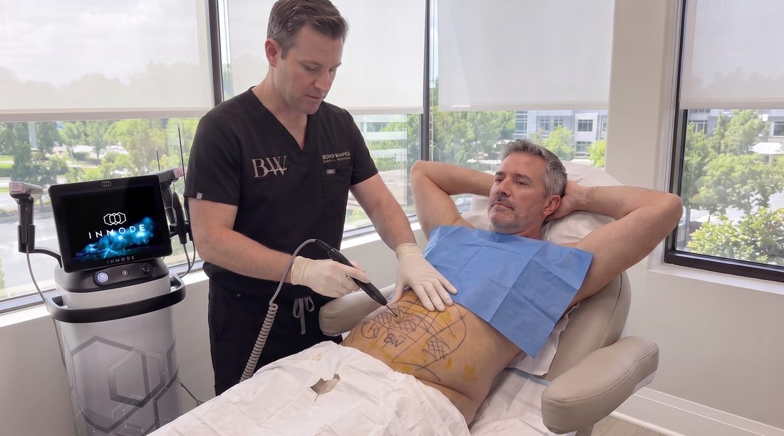 A BodyWorks practitioner performing a minimally invasive radiofrequency treatment on a marked and prepped abdomen, with the InMode console alongside