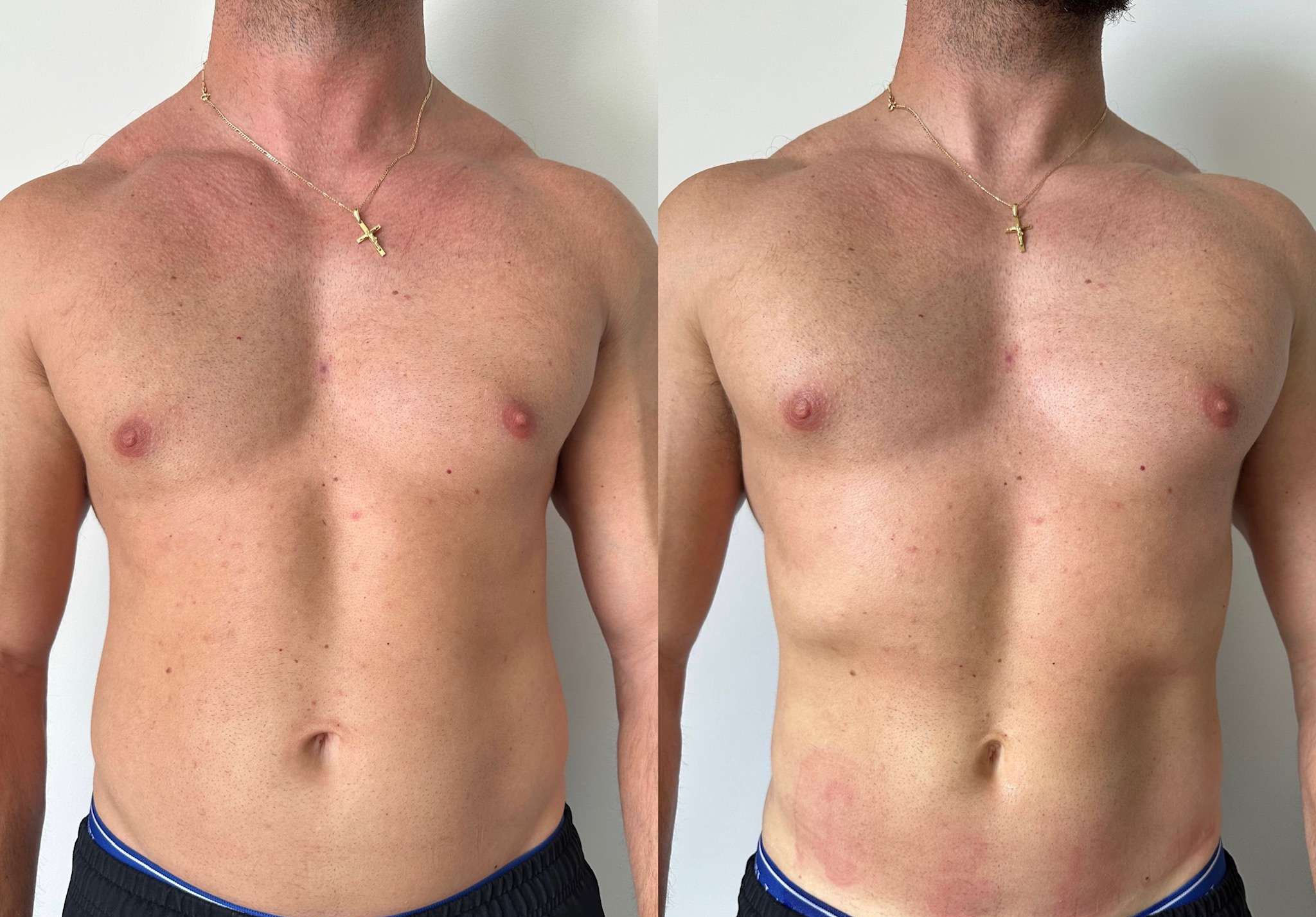 Before & After 4